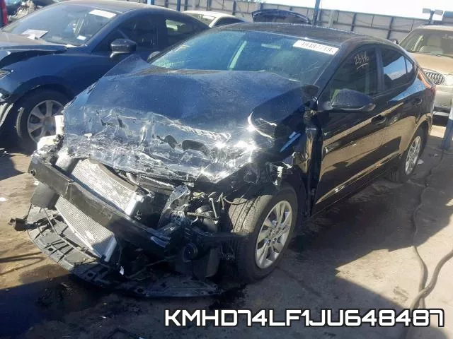 KMHD74LF1JU648487 фото 3