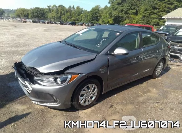 KMHD74LF2JU607074 фото 3