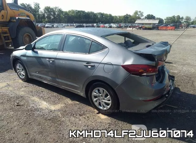KMHD74LF2JU607074 фото 4