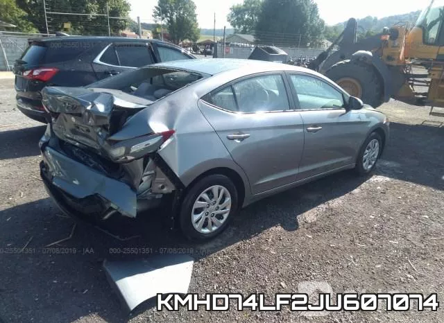 KMHD74LF2JU607074 фото 5