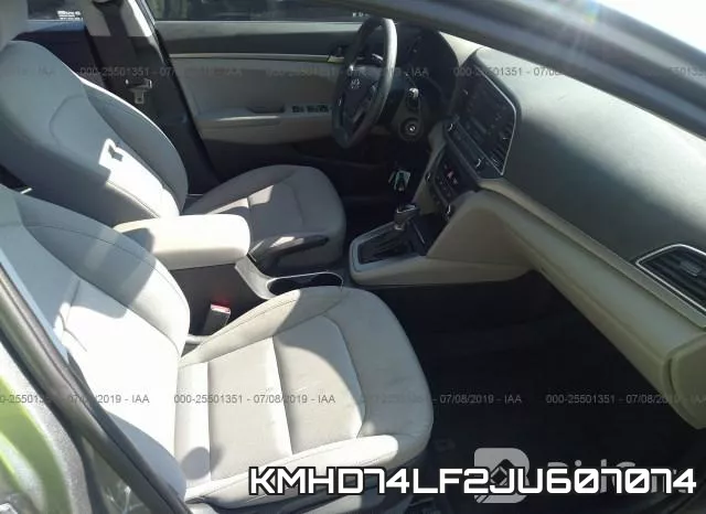 KMHD74LF2JU607074 фото 6