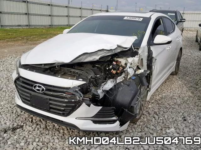 KMHD04LB2JU504769 фото 3