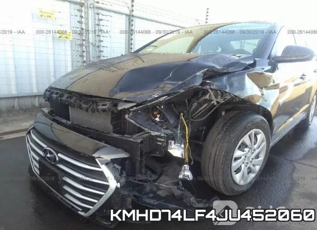 KMHD74LF4JU452060 фото 7