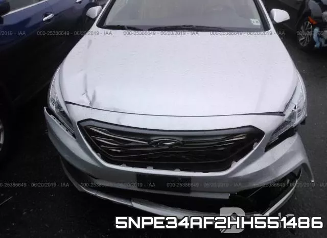 5NPE34AF2HH551486 фото 7