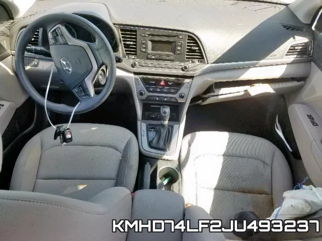 KMHD74LF2JU493237 фото 9