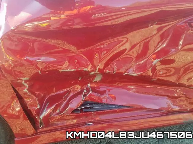 KMHD04LB3JU467506 фото 10