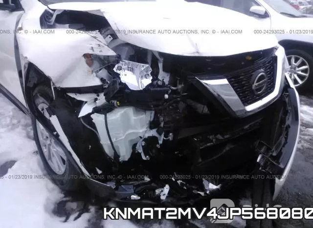 KNMAT2MV4JP568080 фото 7