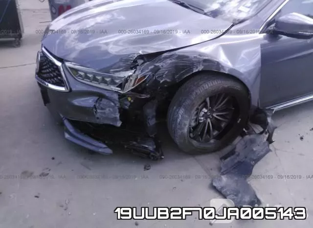 19UUB2F70JA005143 фото 7