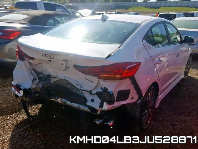 KMHD04LB3JU528871 фото 5