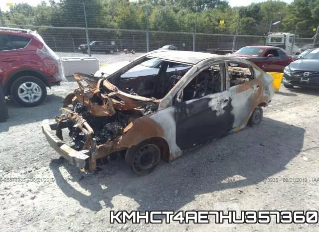 KMHCT4AE7HU357360 фото 3