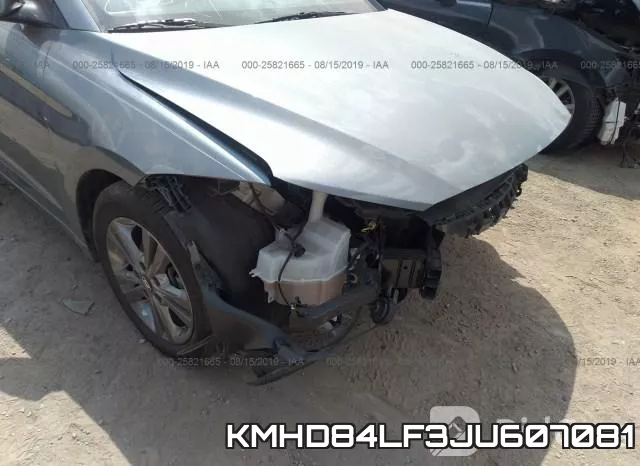 KMHD84LF3JU607081 фото 7