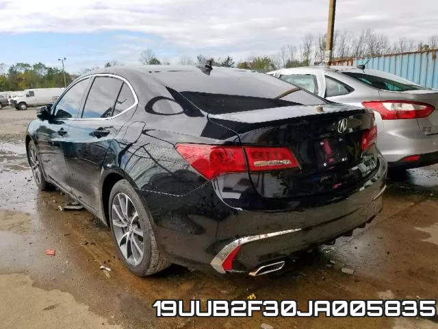 19UUB2F30JA005835 фото 4