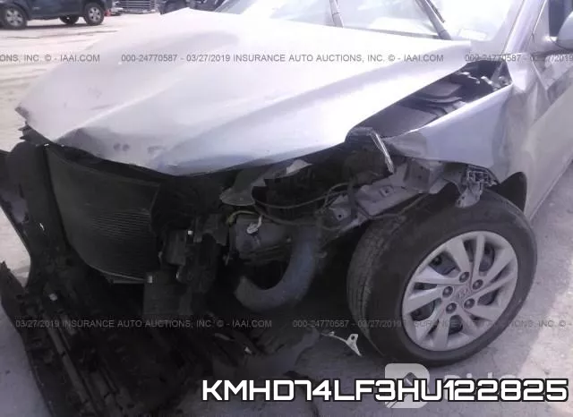 KMHD74LF3HU122825 фото 7