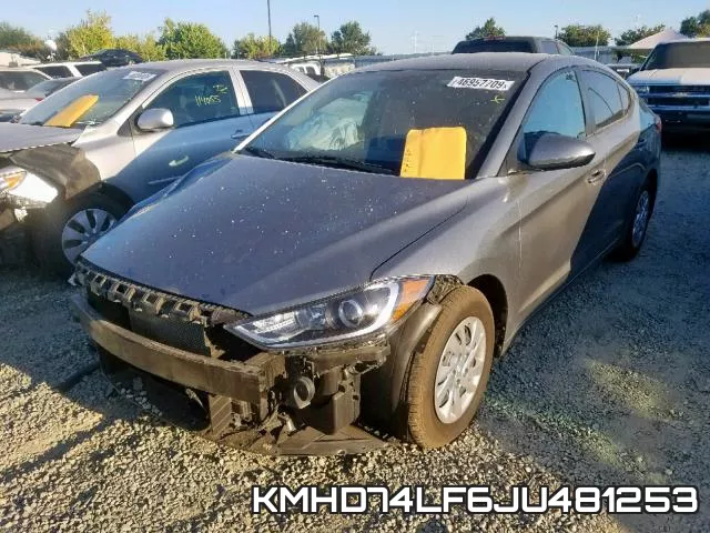 KMHD74LF6JU481253 фото 3