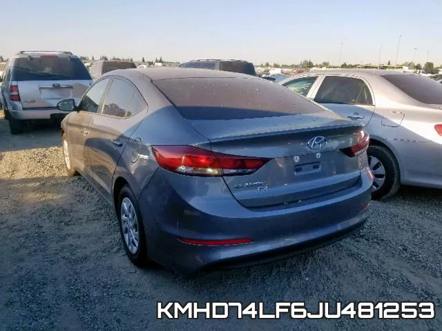 KMHD74LF6JU481253 фото 4