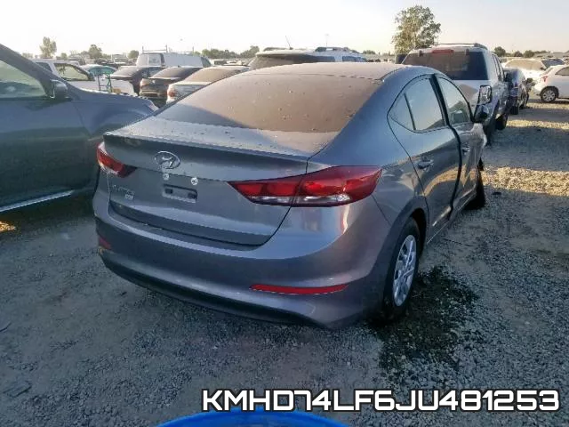 KMHD74LF6JU481253 фото 5