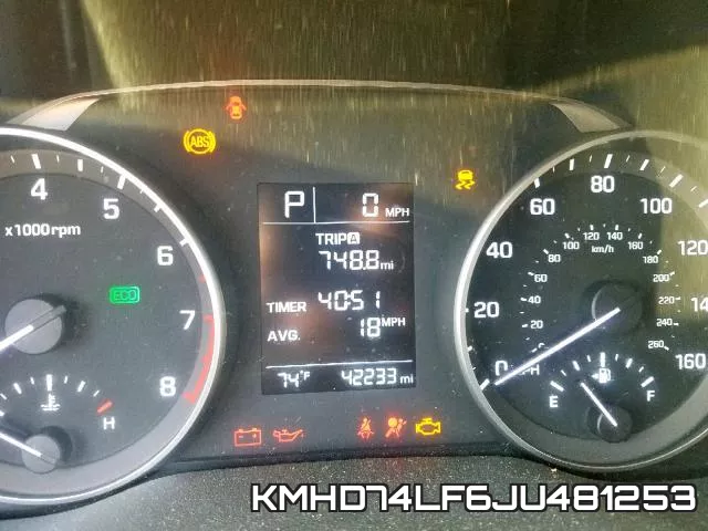 KMHD74LF6JU481253 фото 9