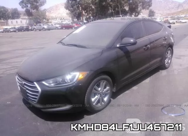 KMHD84LF1JU467211 фото 3