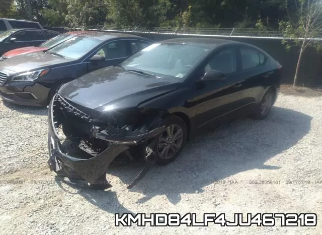 KMHD84LF4JU467218 фото 3