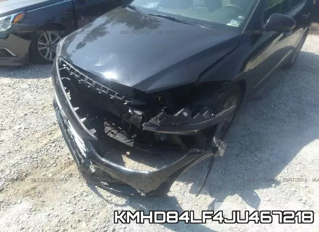KMHD84LF4JU467218 фото 7