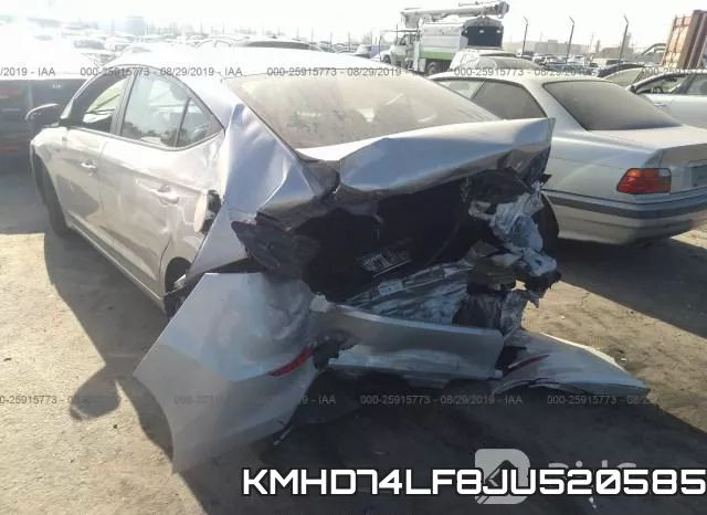 KMHD74LF8JU520585 фото 4