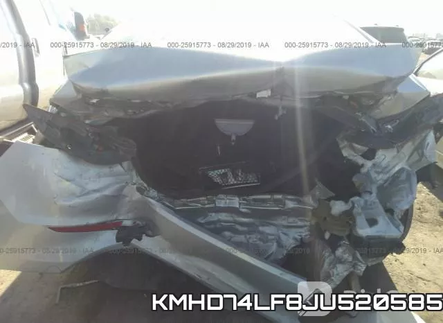 KMHD74LF8JU520585 фото 7