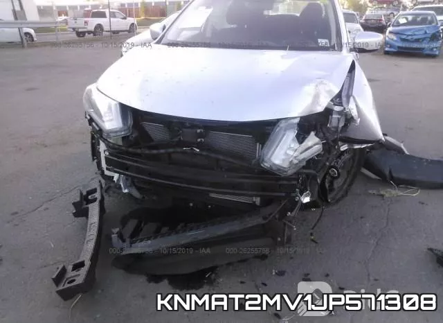 KNMAT2MV1JP571308 фото 7