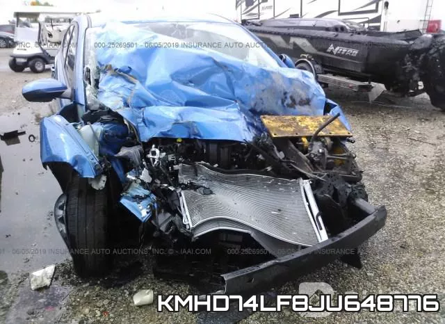 KMHD74LF8JU648776 фото 7