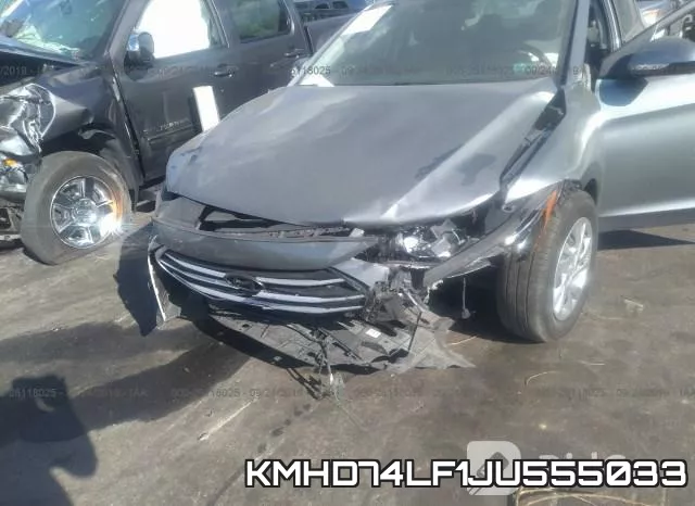 KMHD74LF1JU555033 фото 7