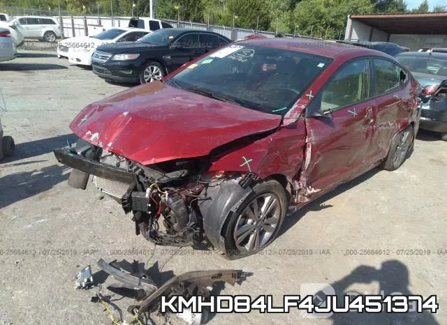 KMHD84LF4JU451374 фото 3