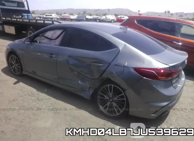 KMHD04LB7JU539629 фото 4