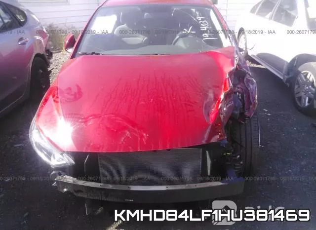 KMHD84LF1HU381469 фото 7