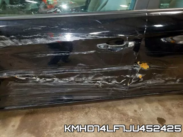 KMHD74LF7JU452425 фото 10