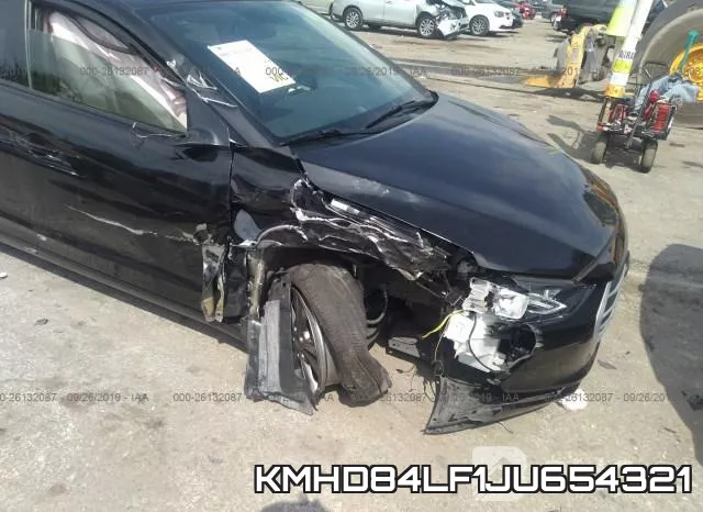 KMHD84LF1JU654321 фото 6
