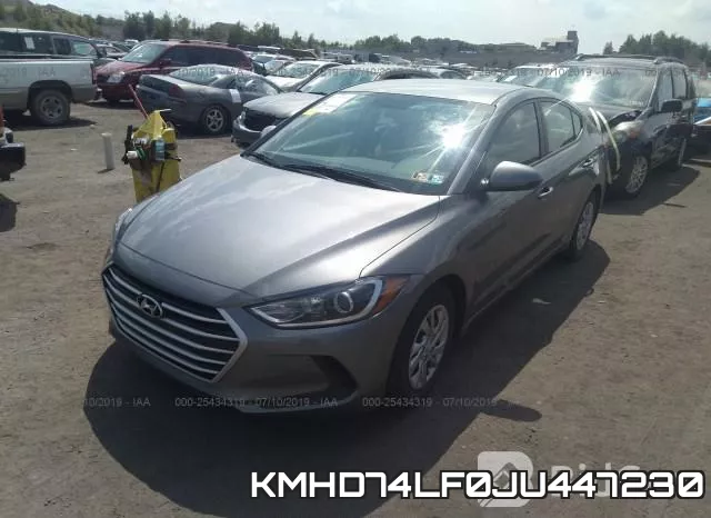 KMHD74LF0JU447230 фото 3