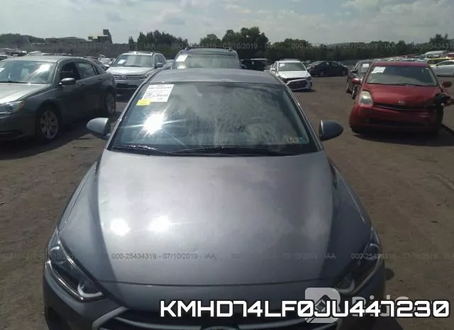 KMHD74LF0JU447230 фото 7