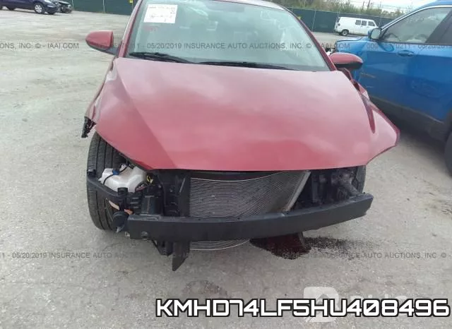 KMHD74LF5HU408496 фото 7