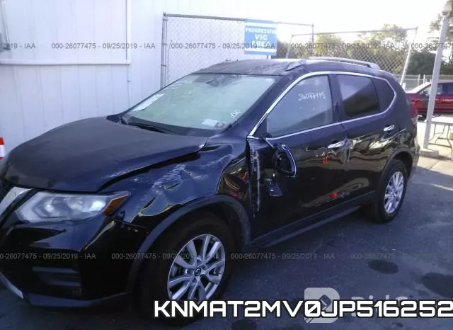 KNMAT2MV0JP516252 фото 7