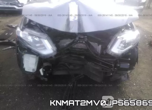 KNMAT2MV0JP565869 фото 7