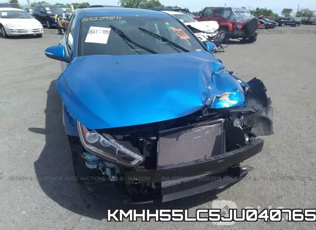 KMHH55LC5JU040765 фото 7