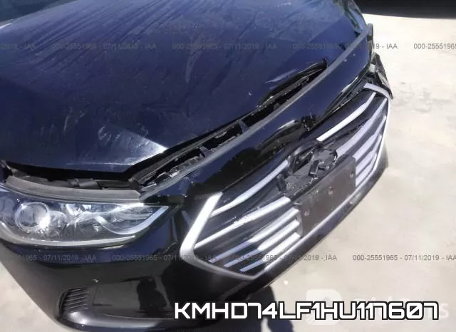 KMHD74LF1HU117607 фото 7