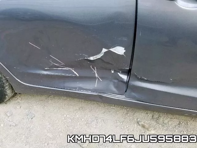 KMHD74LF6JU595883 фото 10