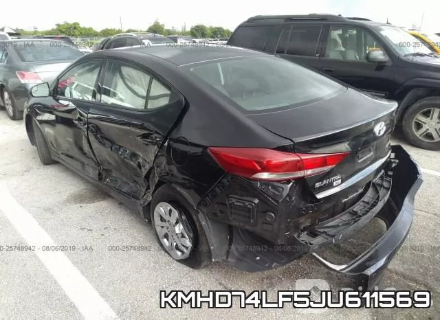 KMHD74LF5JU611569 фото 4