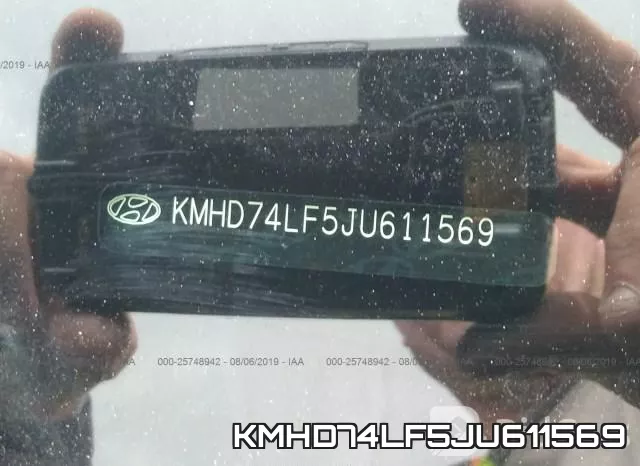 KMHD74LF5JU611569 фото 9