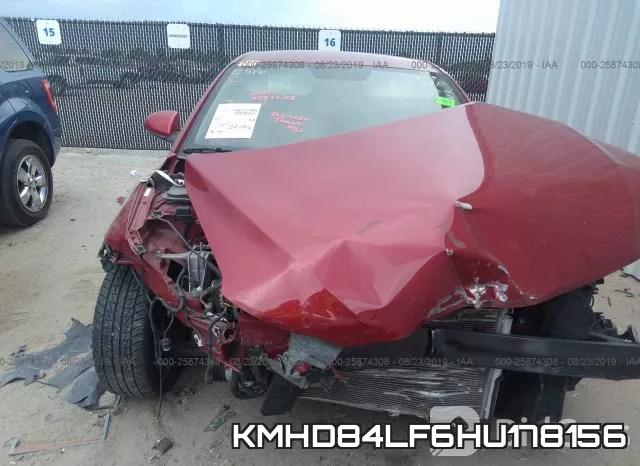 KMHD84LF6HU178156 фото 7
