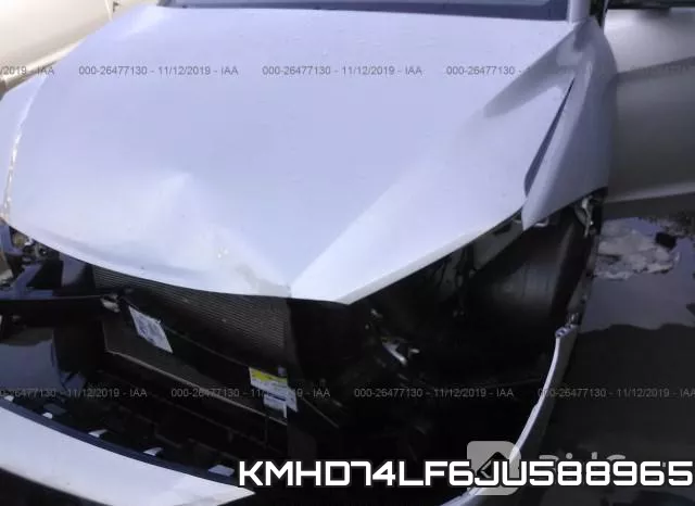 KMHD74LF6JU588965 фото 2