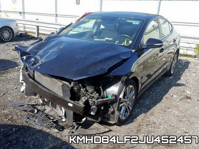 KMHD84LF2JU452457 фото 3