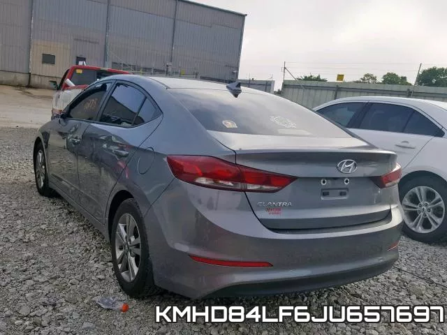 KMHD84LF6JU657697 фото 4