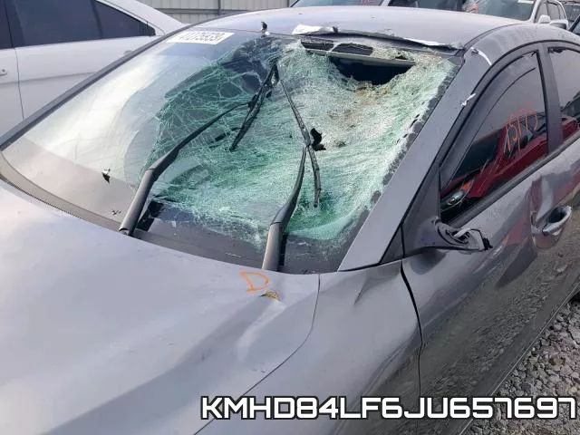 KMHD84LF6JU657697 фото 10