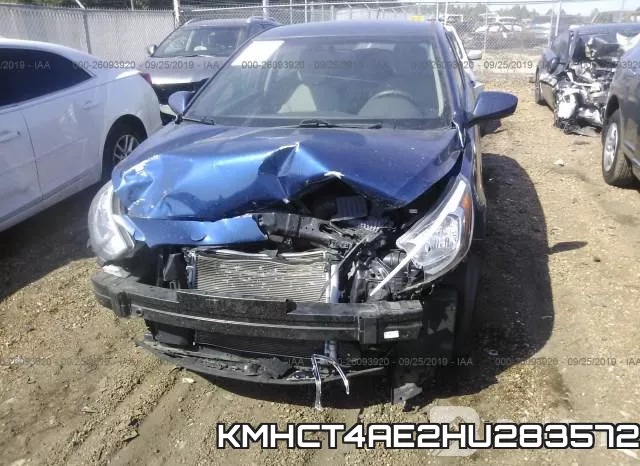 KMHCT4AE2HU283572 фото 7